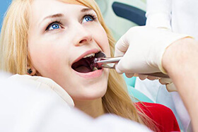 Young woman receiving wisdom tooth extraction