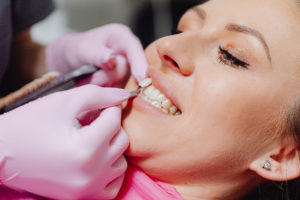 Woman at dentist for veneers